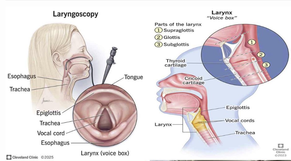 ৩ সপ্তাহের বেশি গলা ব্যথা? উপেক্ষা করবেন না, এটি ক্যানসারের লক্ষণ হতে পারে