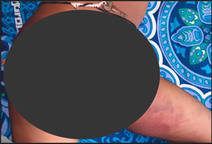শেরপুরে মাদ্রাসার দুই শিশু নির্যাতনের অভিযোগ, পালালেন ২ শিক্ষক