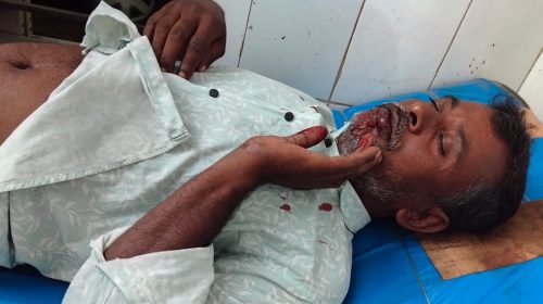 শেরপুরে জমি নিয়ে বিরোধে হামলা, পরদিনই মামলা