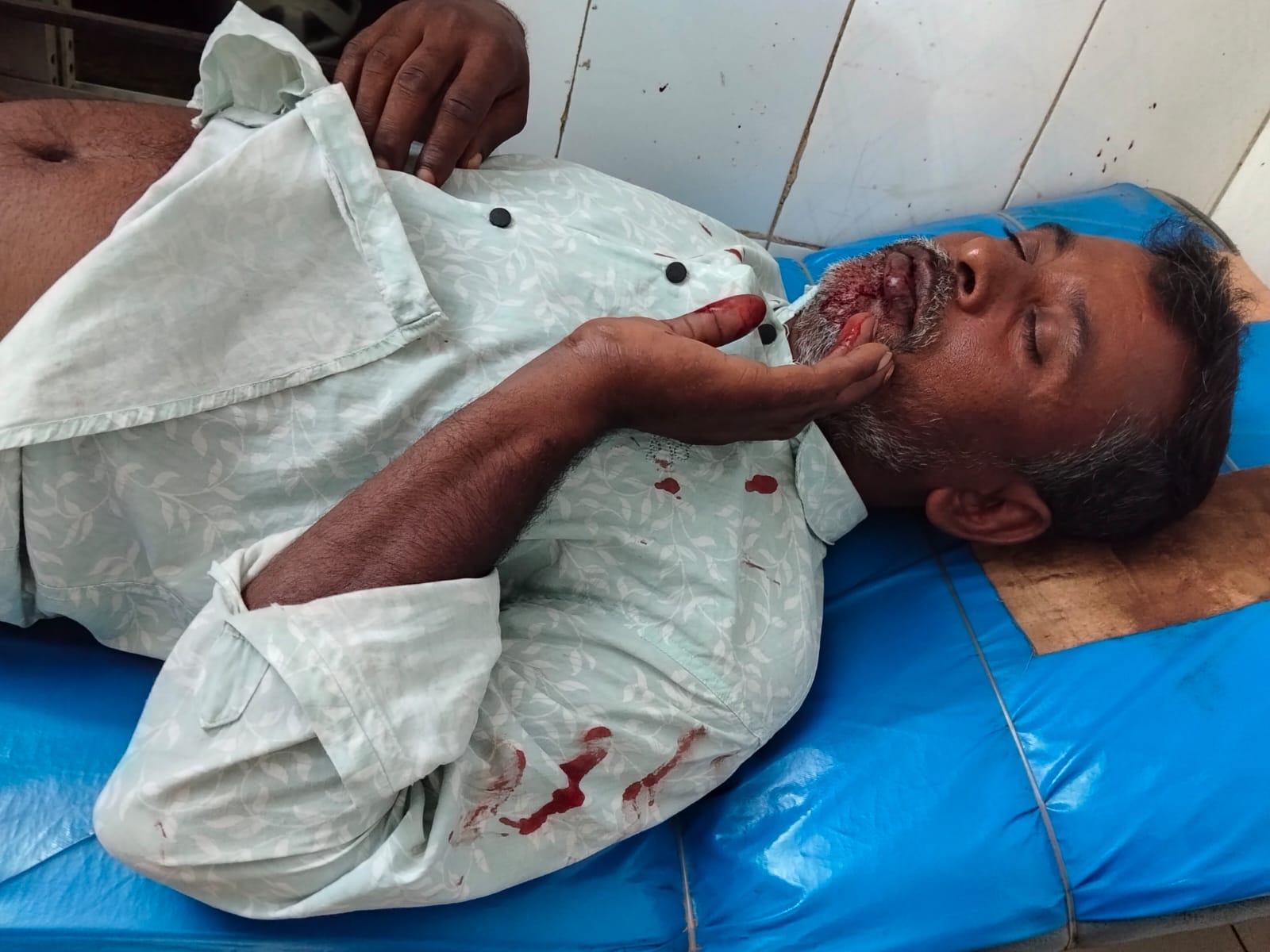 শেরপুরে জমি নিয়ে বিরোধে হামলা, পরদিনই মামলা